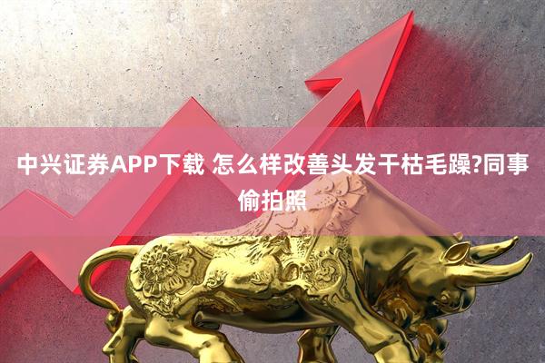 中兴证券APP下载 怎么样改善头发干枯毛躁?同事偷拍照
